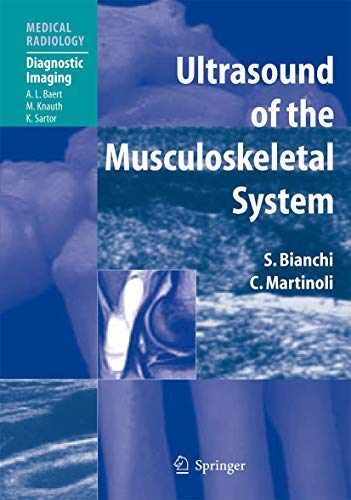 Ultrasound of the – Hardcover, by Bianchi Stefano; Martinoli – Acceptable