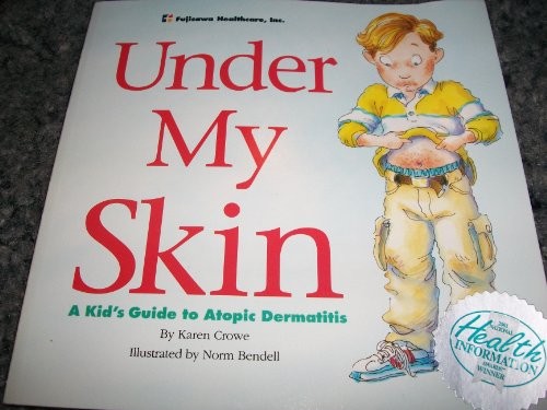 Under My Skin: A Kid’s Guide to Atopic Dermatitis by Crowe, Karen