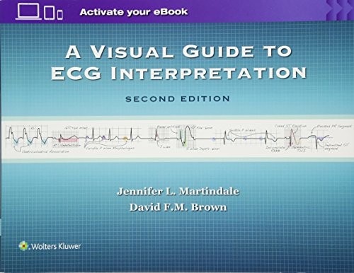 A VISUAL GUIDE TO ECG INTERPRETATION By Martindale Jennifer L Md & Brown David F