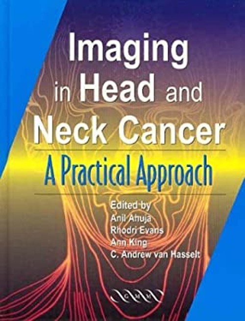 Imaging of Head and Neck Cancer Hardcover