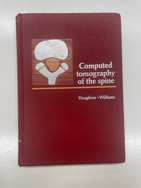 Computed Tomography Of The Spine Victor Haughton Alan Williams 1982