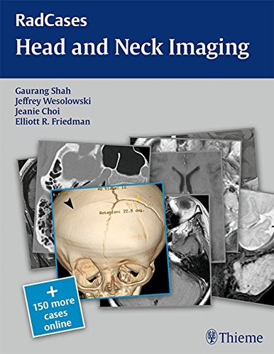 RADCASES HEAD AND NECK IMAGING By Gaurang Vrindavan Shah & Jeffrey Robert