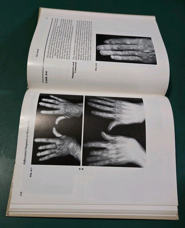 HC Differential Diagnosis In Rheumatology Atlas For The Physcian Andrei Calin VG gallery