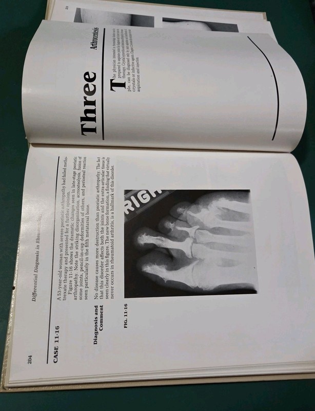 HC Differential Diagnosis In Rheumatology Atlas For The Physcian Andrei Calin VG gallery
