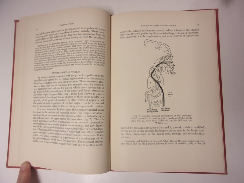 Cerebral Palsy, Cyril B. Courville, vintage medical textbook (1954) gallery