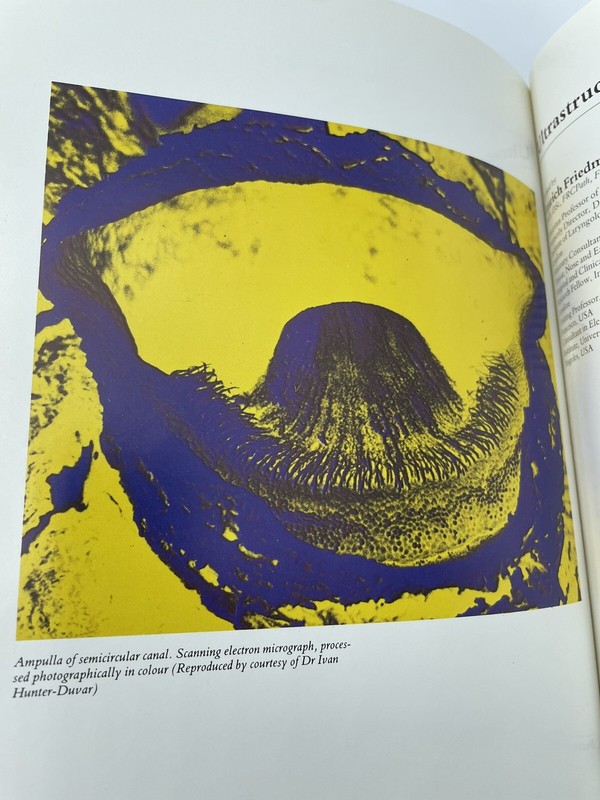 Ultrastructural Atlas of the Inner Ear 1984 325 pages Imrich Friedman Hardcover gallery